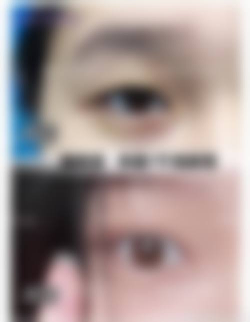 二、深圳仁安雅整形医院怎么样?