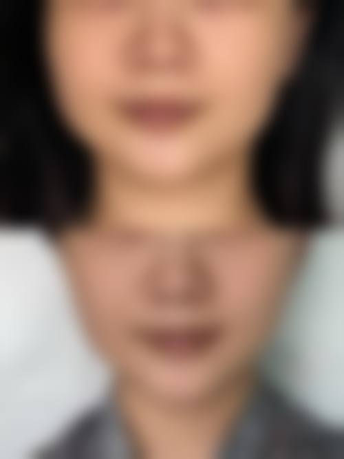 八、西安新城东方丽诚医院预约方式