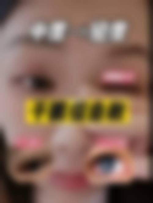 特色项目与技术优势:覆盖全眼科,微创精细
