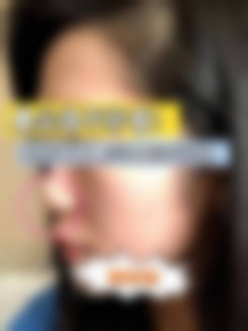 五、东阳市人民医院(整形科)价格表