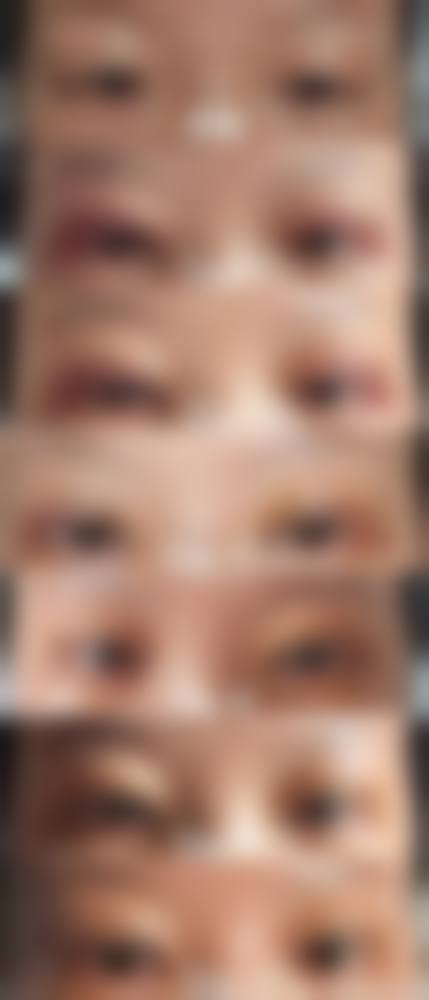 九、西安新城东方丽诚医院真实的患者评价