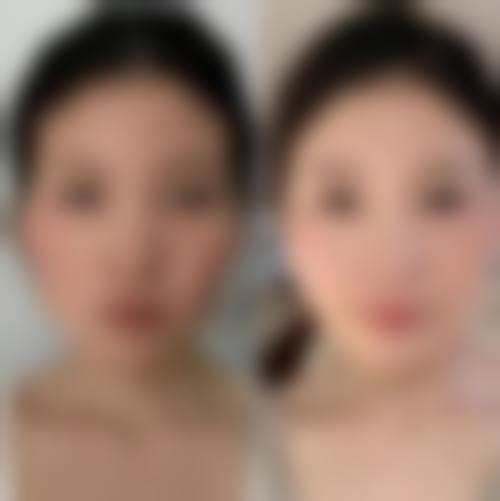 二、杭州桐庐韩加整形医疗美容门诊部怎么样?