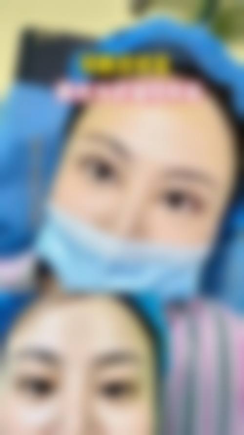 临床实例分享 陈春鹏