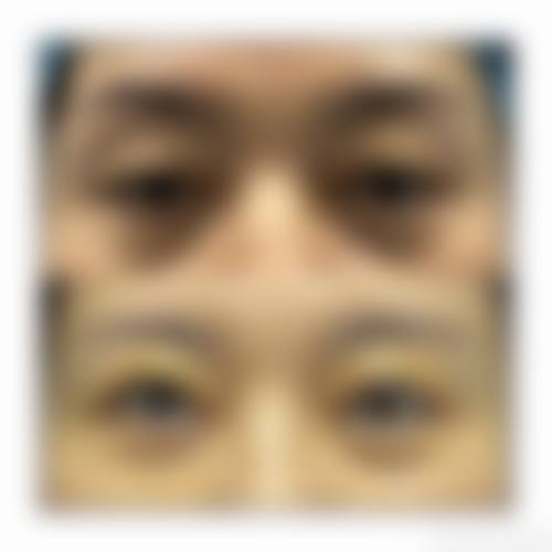 优惠活动详情:用诚意迎接每一位患者
