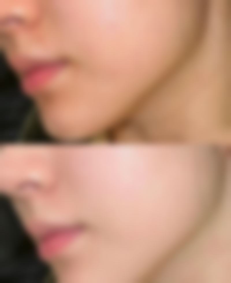 五、选择专精医生进行设计的重要性