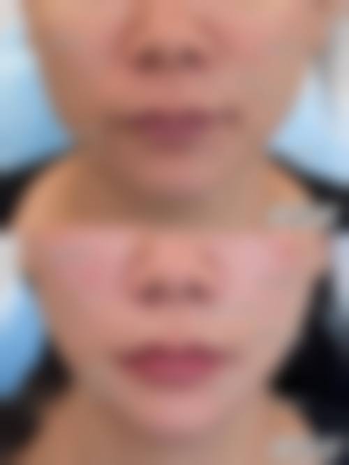 常见问题（FAQ）