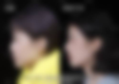 八、泉州泉港区卫生防疫站医学美容医院预约方式