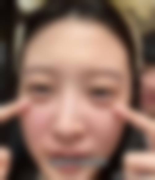 八、重庆梦美医疗美容门诊部真实的患者评价