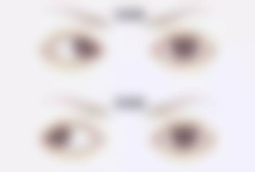 临床实例分享