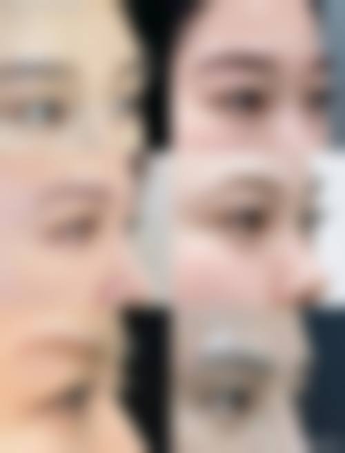 四、Verite Clinic名古屋特色项目