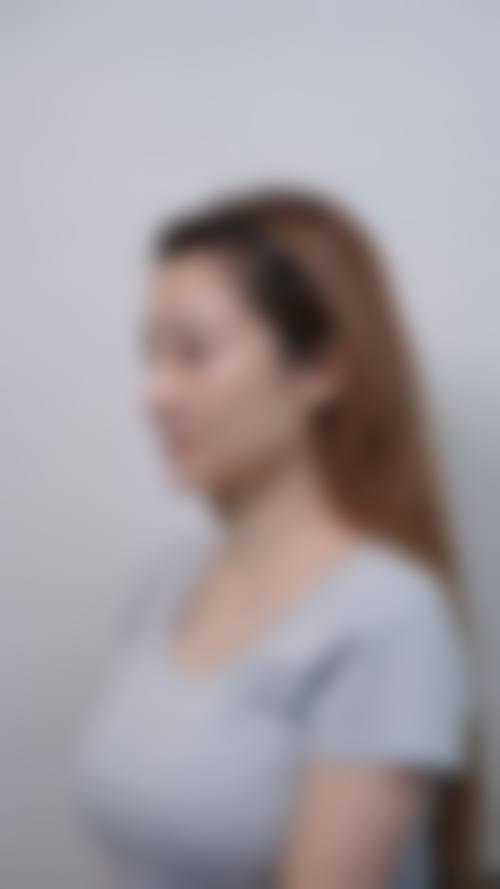 八、慈溪艾博尔妇产医院医疗美容科真实的患者评价